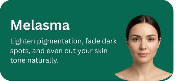 Melasma